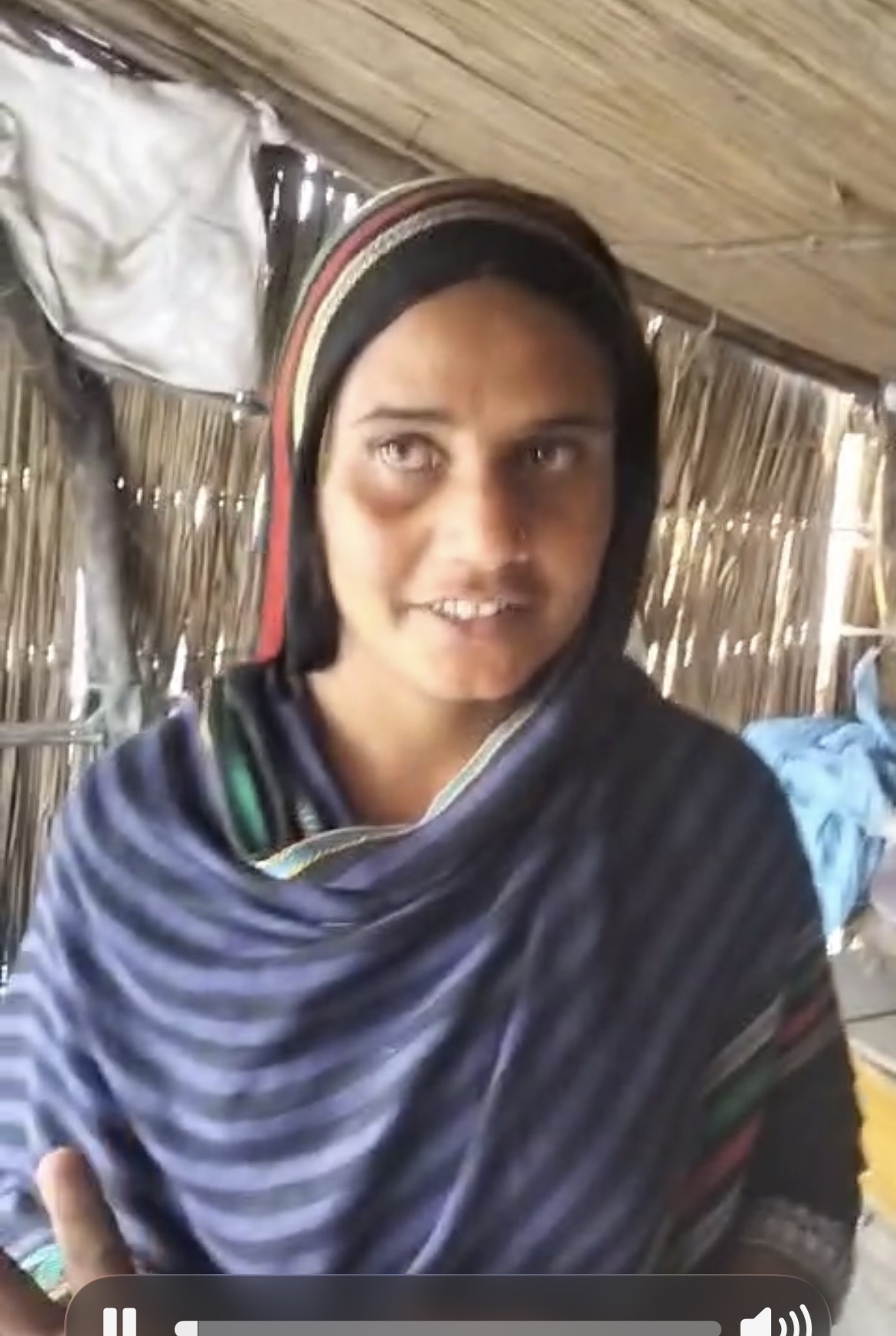 Speech Impaired Lady Wants to Sew